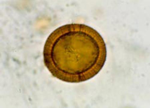Fig. 6. Huevo de taenia sp: S. Harter, “First Paleoparasitological Study of an Embalming Rejects Jar Found in Saqqara, Egypt”, Mem Inst Oswaldo Cruz, (2003), Vol. 98 (Suppl. I): 119-121.